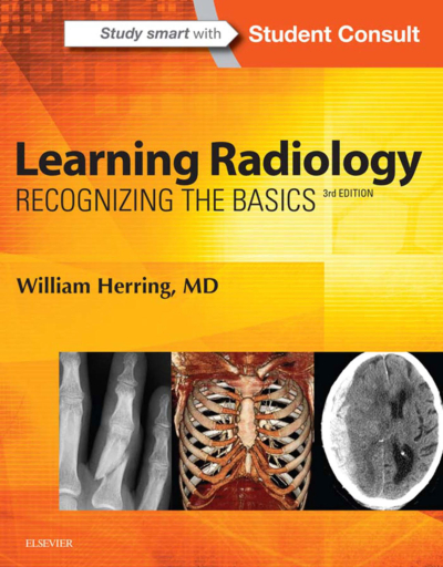 Learning Radiology: Recognizing The Basics / William Herring Fenomen Fotokopi - YKS - KPSS - ALES